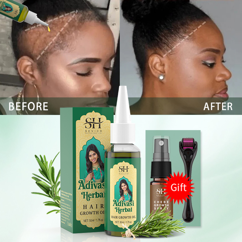 Minyak Pertumbuhan Rambut Ayur - Ayurvedic & Herbal Wellness Kits ulasan dan harga