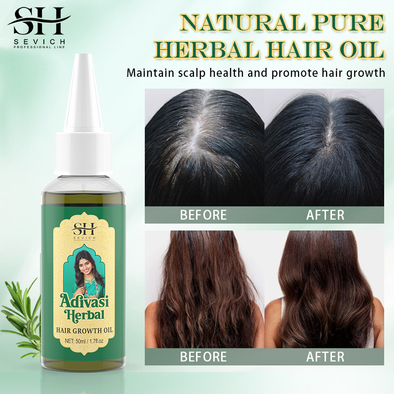 Ayurveda minyak penumbuh rambu - Ayurvedic & Herbal Wellness Kits ulasan dan harga